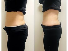 ヨサパーク プラム(YOSA PARK Plum)/before★after