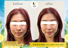 ウィズ鍼灸整骨院 十三院(with.鍼灸整骨院)