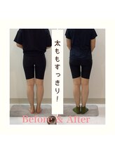 スタイルラボ高松/産後の骨盤矯正の効果♪