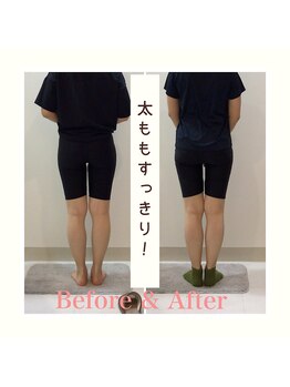 スタイルラボ高松/産後の骨盤矯正の効果♪