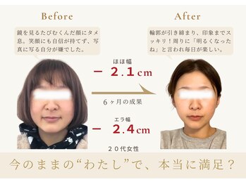 アロハ(ALOHA.)/今のままの“私”で本当に満足?