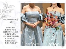 アモリール(Amolir)/ブライダルエステ6ヶ月