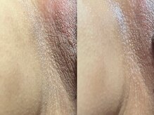 スリール(sourire)/話題のフェムケア