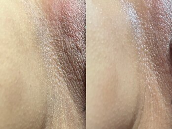 スリール(sourire)/話題のフェムケア