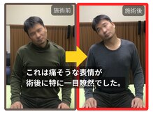 まこと整骨院/ずっと取れない長引く肩の痛み４