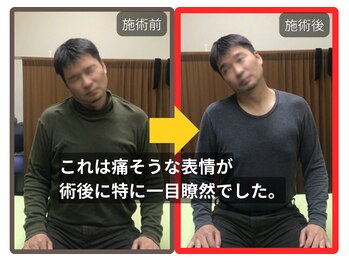 まこと整骨院/ずっと取れない長引く肩の痛み４