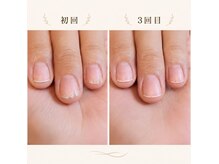 フィオーレフィオーレ 銀座の雰囲気（薄い、弱い、痛んだ爪に。続けるケアで、自爪は変わる。）