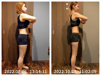 美容整体院元 光の森店/ダイエット3ヵ月 before&after