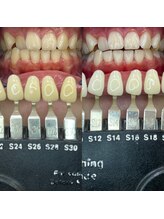 トウキョウスワーズ 池袋店(TOKYO SWRS)/#ホワイトニング #池袋 #渋谷