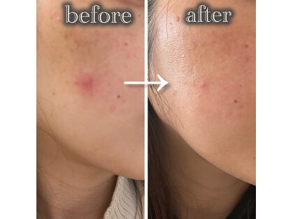 ホワイト ターコイズの写真