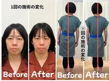 ゆず鍼灸整骨院の雰囲気（14年の経験値×技術力で、1回の施術に確かな変化を）