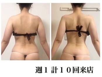 キレイ(KIREI)/衝撃のbefore/after　30代