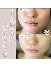 リラクゼーションサロン ラキ(laki)/トロイアルケ