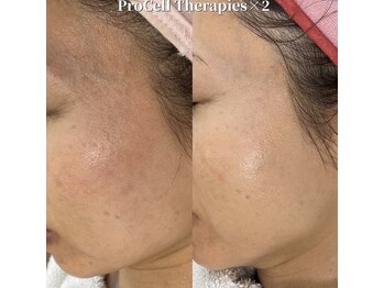 クレア(crea)/お肌【プロセルセラピーズ】金山