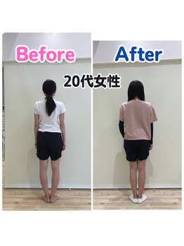 こんだ整骨院/O脚改善ビフォーアフター