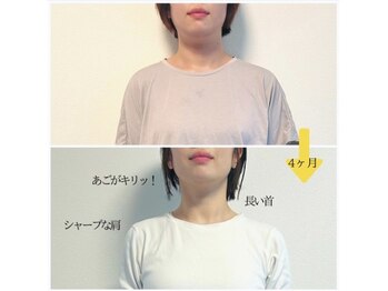 ポノフィット(PONO FIT.)/症例／首、肩、背中