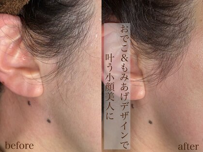 コモレビ(komorebi)の写真