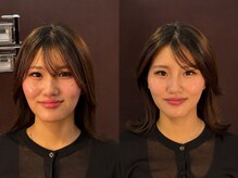 ルディア 堀江店(ledia)の雰囲気（大阪美容鍼/堀江/心斎橋/輪郭矯正鍼/小顔/エラ張り/食いしばり/）