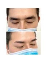 アイビー 神保町店(i.b)/眉【before⇒after】２９