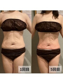 セイリキ(SEIRIKI)/★痩身ダイエットお客様のお声★