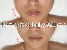 キーオブフェイス(Key of Face)の雰囲気（1度の施術でフェイスラインが「シュッ」と小顔に♪EMS×プラズマ）
