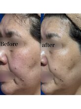 ヒール(heal)/症例