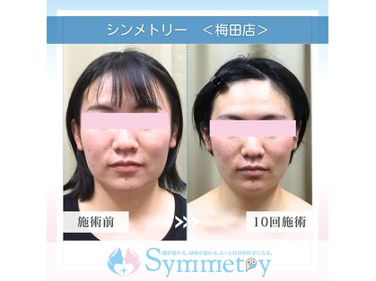 小顔矯正専門店 シンメトリー 梅田の写真