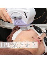 エステサロン ヴリエ 立川店/◆BBL光フェイシャル◆
