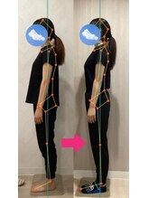 ラクリエ 姫路駅前院(La Creer)/お客様ビフォーアフター