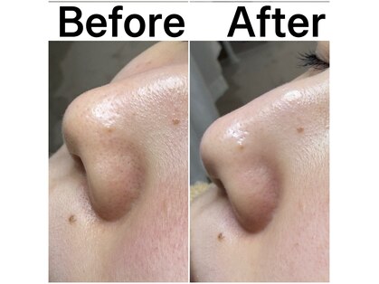 プルティティア 池下 今池 覚王山(Pultitia)の写真