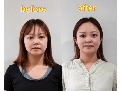 アズール(azure)の写真