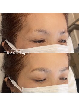 フレイズラピス(FRASE Lapis)/【ハリウッドブロウリフト】
