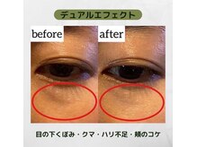 アクティブエイジング 大阪店/【エンビロン】オトナ目元