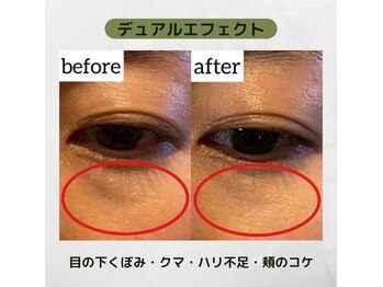 アクティブエイジング 大阪店/【エンビロン】オトナ目元