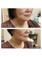 ワイズ 宜野湾鍼灸整骨院/美容鍼