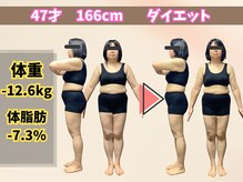 ほんじょう整骨院 美容整体/北九州/八幡西区/ダイエット