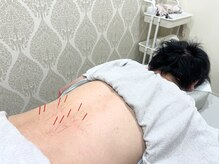 ケーナイン(K-nine)/☆鍼打ち放題☆