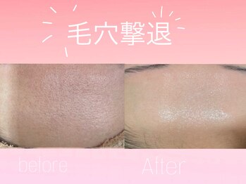 エステティック　レイビス 渋谷店(RAYVIS)