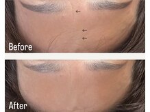 リタ(Rita.)/気になるおでこのシワも薄く