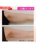 二の腕　集中
