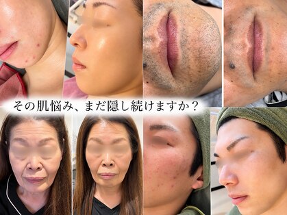ヴェーラベレッツァ(Vera Bellezza)の写真