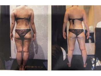 パーフェクトボディプレミアム 名古屋栄店(PERFECT BODY PREMIUM)/お客様 ビフォーアフター(31)