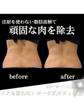 クリニカルボーテ 心斎橋院(CLINICAL BEAUTE)/きつくなったズボン綺麗に履ける