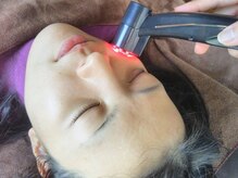 やまざき鍼灸整骨院
