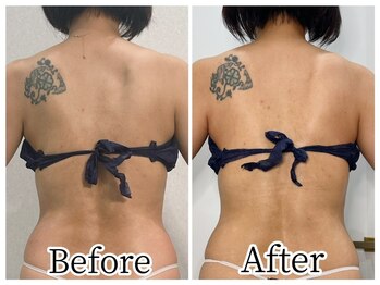 イデアルボーテ/ブライダル予定の方に人気◎