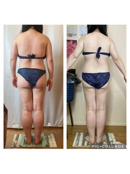 アクアモア/アクアモアの痩身★BeforeAfter