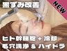 ●リピ多数｜極上!!黒ずみ改善★スチーム毛穴洗浄&ハイドラ《施術９STEP》