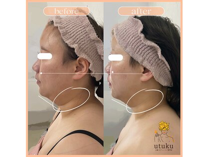 ウツク(utuku)の写真