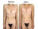 ブレスト 新宿本店(Breast)の写真