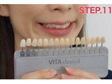 ホワイトニングサロン 四日市white/ケア前の歯の色とチェック